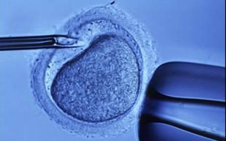 ivf